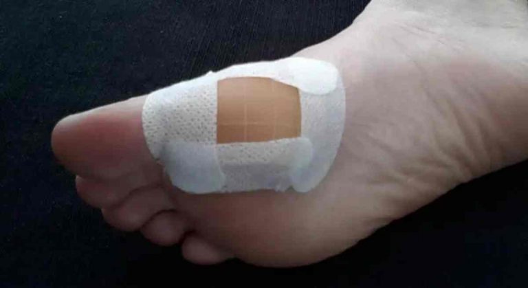 How Does The Hydrocolloid Dressing Work_