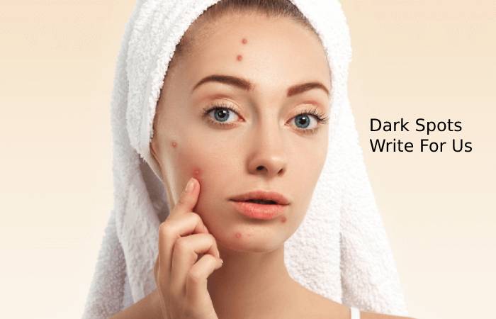 Dark Spots Write For Us-Guest Post, and Submit Post