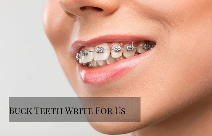 Buck Teeth Write For Us