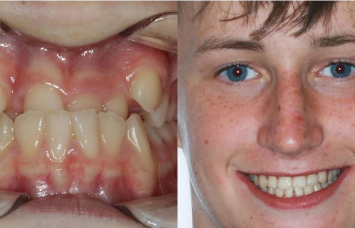 Can you show before-and-after cases or patient results?