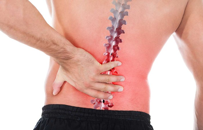 L4-L5 Disc Bulge Treatment